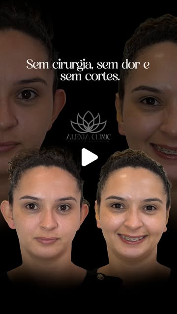 Capa de um caso publicado pela Alexia Clinic